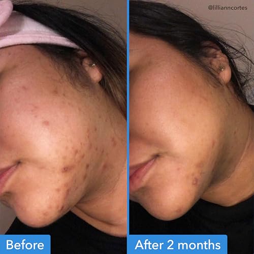 Good Molecules Discoloration Correcting Serum Parent