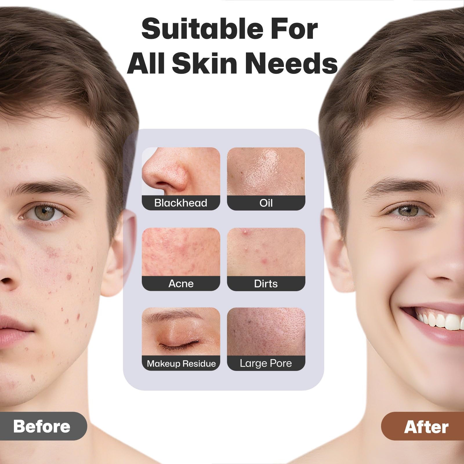 Silicone Facial Cleansing Brush with Heat Massage Rechargeable