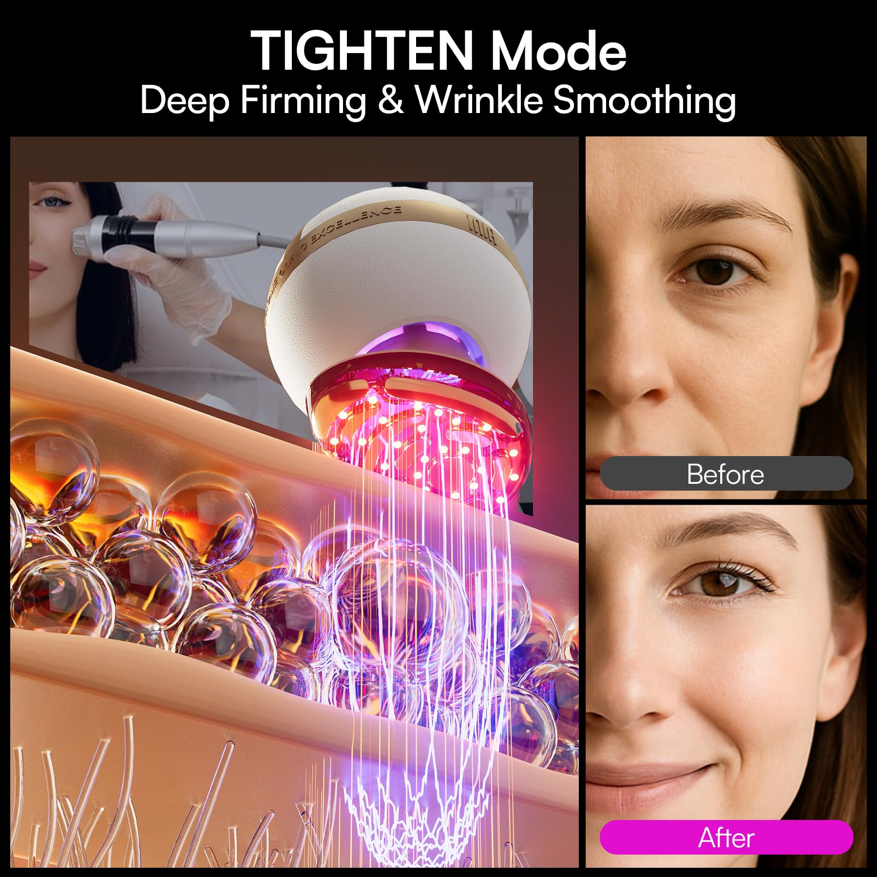 8-in-1 Microcurrent Facial Device with LED & Thermal Care